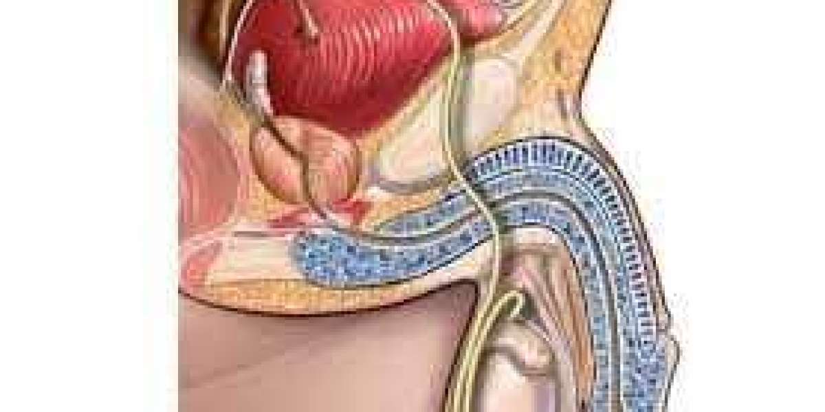 Optimal Evaluation Frequency for Prostate Cancer Surveillance