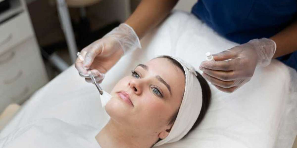 Revitalize Your Skin in Tamworth with Skingoodies Australia's Chemical Peels