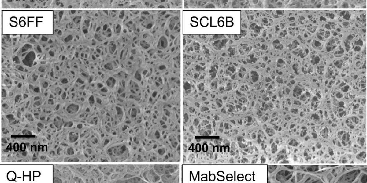 CD Bioparticles Introduces Functional Agarose Particles for Biomedical Research Applications