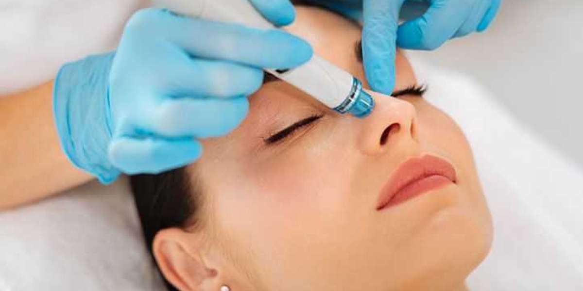 Best HydraFacial in Edmonton: A Comprehensive Guide by Vitaluxe